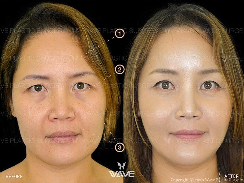 plastic surgeon rhinoplasty plastic surgeon rhinoplasty