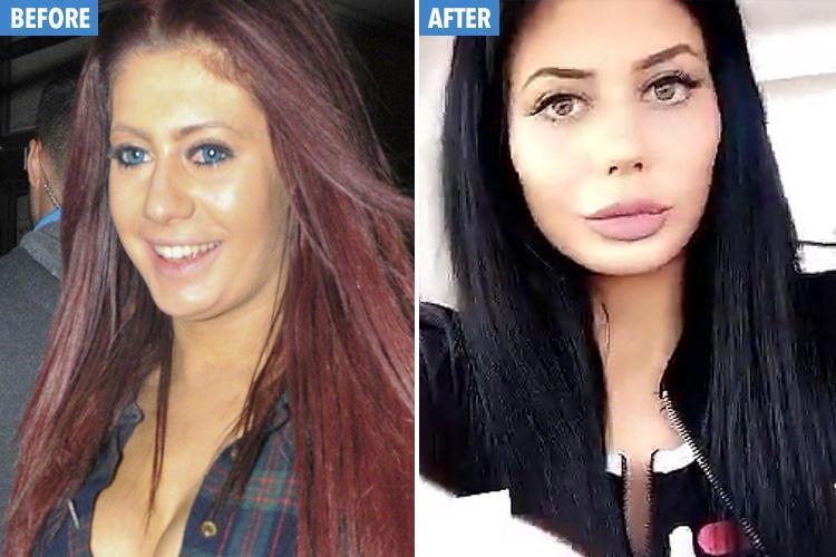 plastic surgeon rhinoplasty plastic surgeon rhinoplasty
